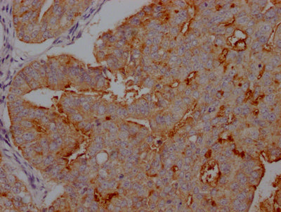MUC16 Antibody