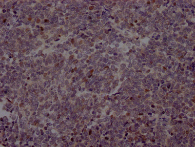 EZH2 Antibody