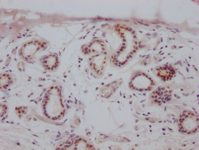ESR1 Antibody