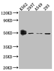WT1 Antibody