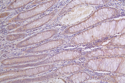 GLA Recombinant Monoclonal Antibody
