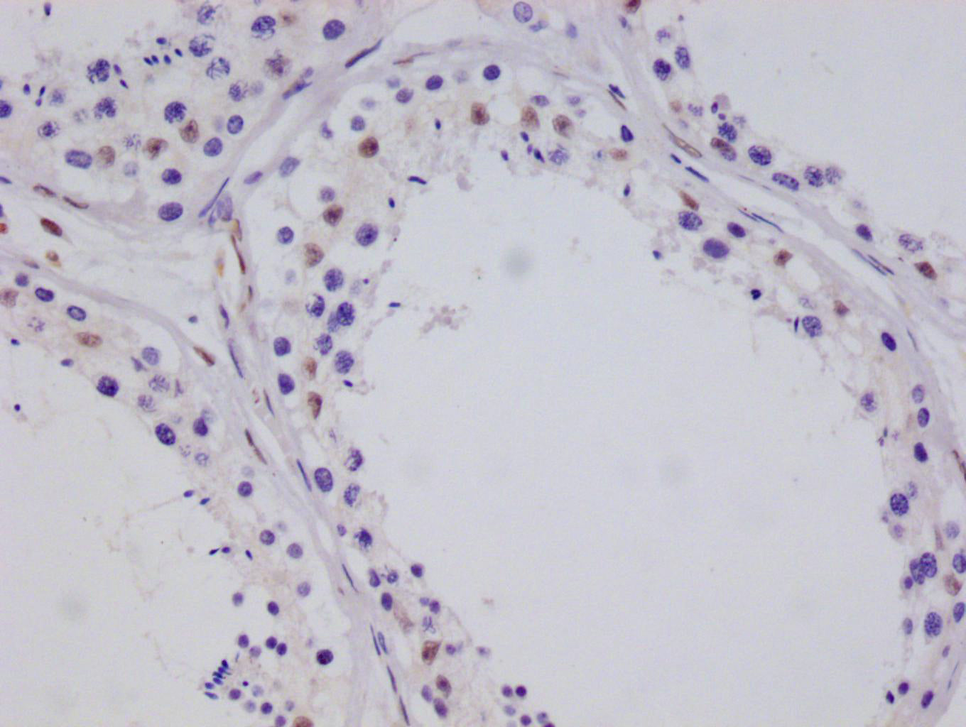 CRTC3 Antibody