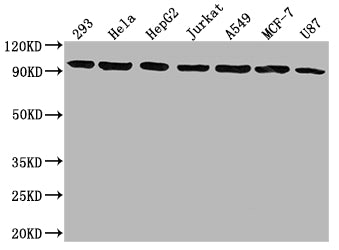 NR3C1 Antibody
