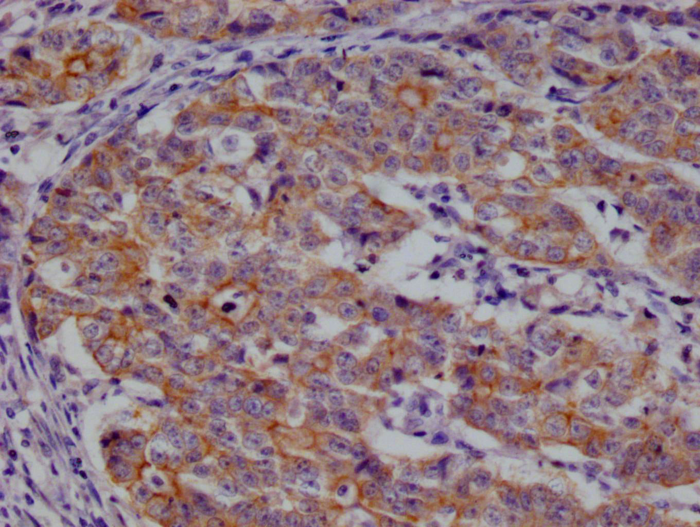 CSN2 Antibody