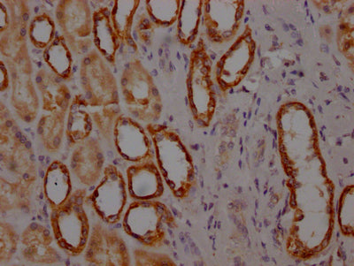 MYBBP1A Antibody
