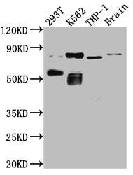 PRKCQ Antibody