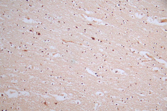 Phospho-MDM2 (S166) Recombinant Monoclonal Antibody