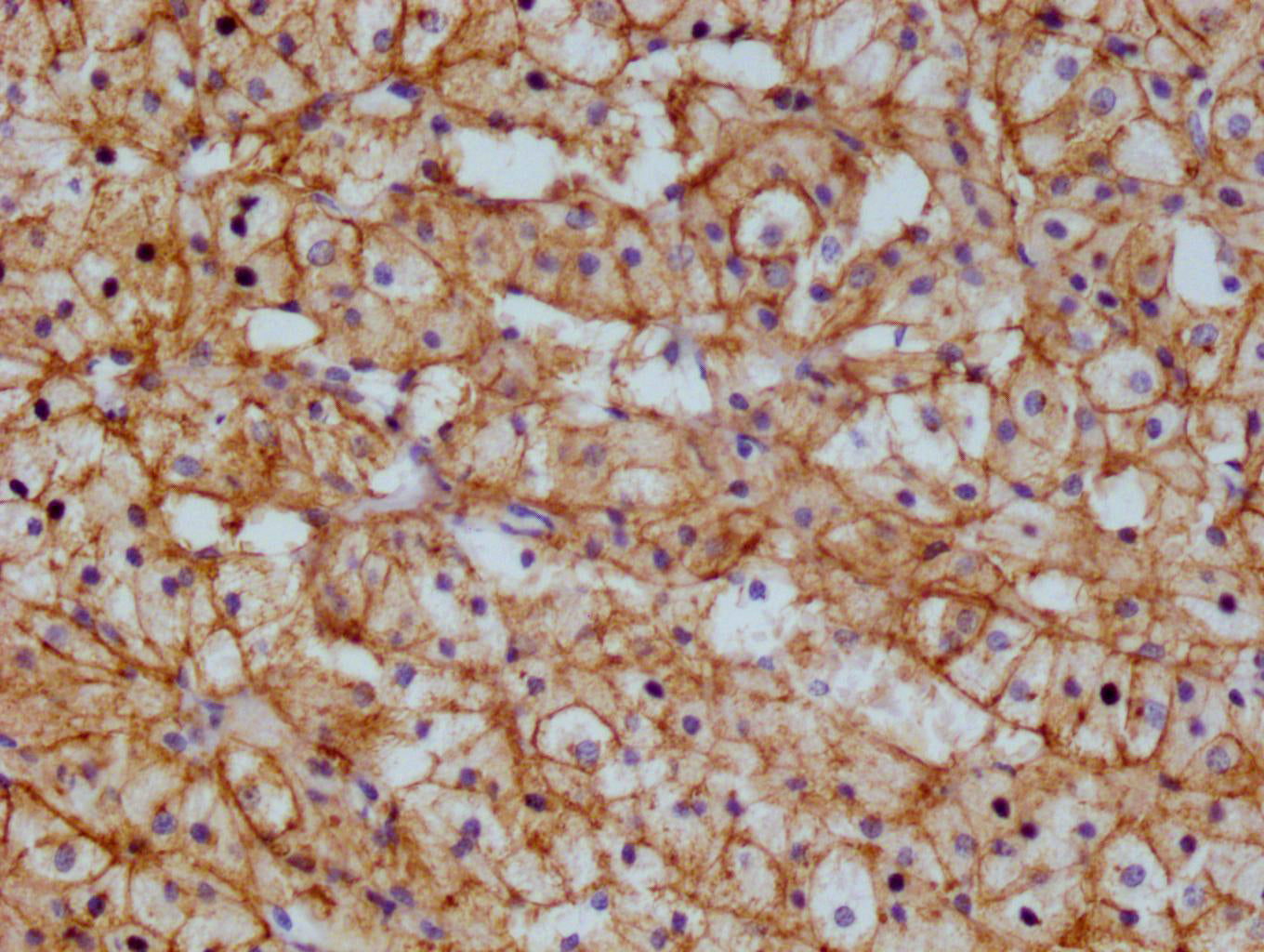 ABCB1 Antibody