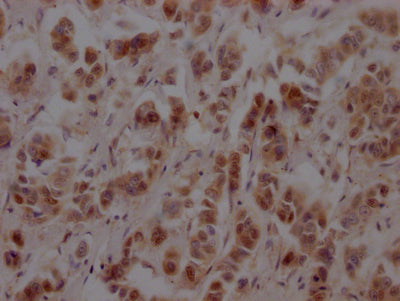 NUP153 Antibody