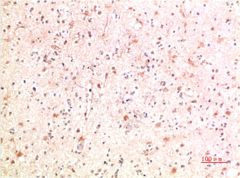 PI3 Kinase P85 Rabbit pAb