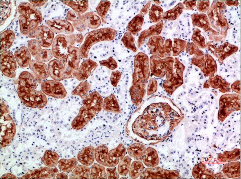 CD10 Rabbit pAb