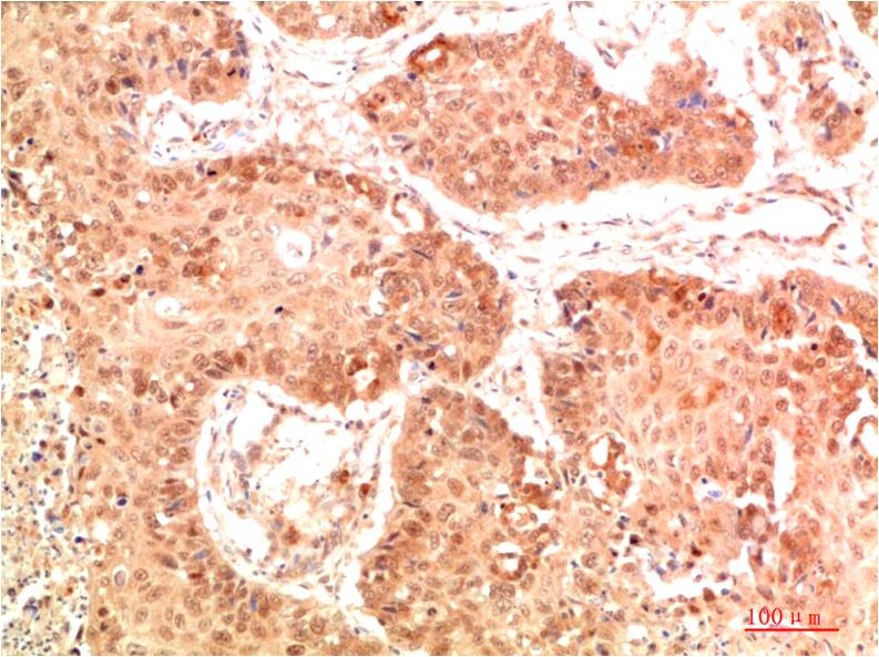Nrf2 Rabbit pAb