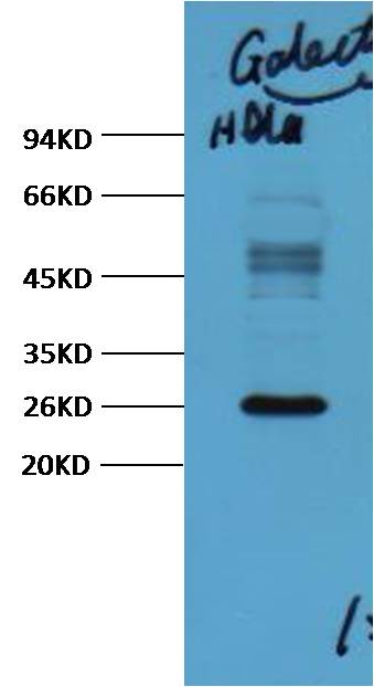 Galectin-3 Mouse mAb