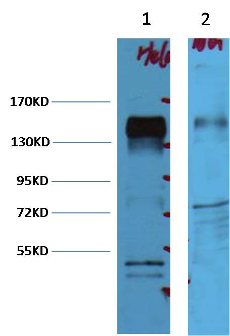 ErbB-2/HER-2  Mouse mAb