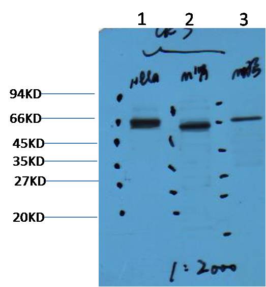 CK7 Mouse mAb