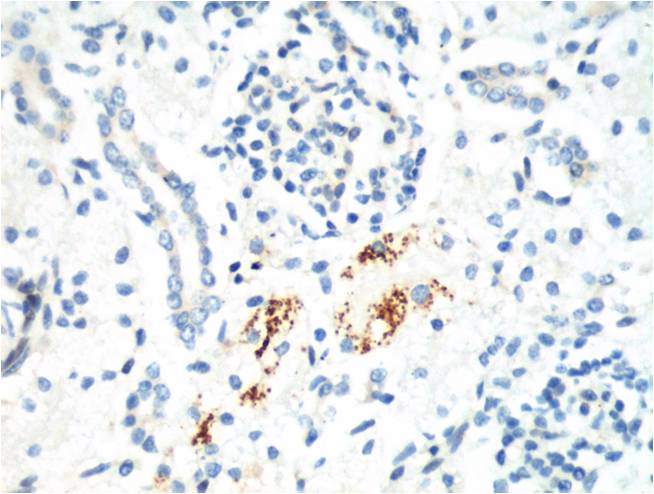 Kif 7 Mouse mAb