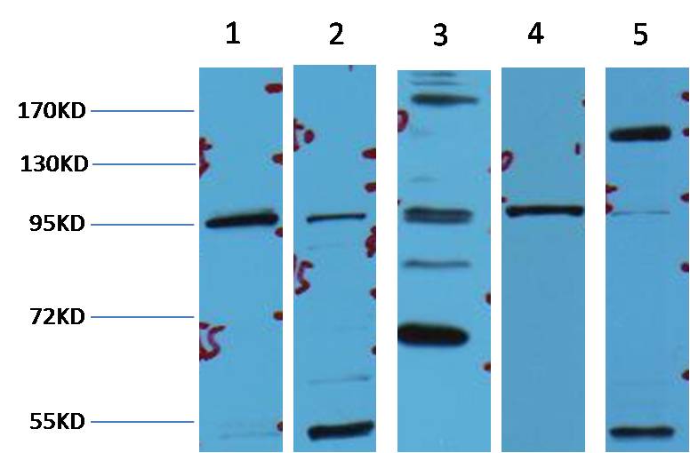 β-Catenin Mouse mAb