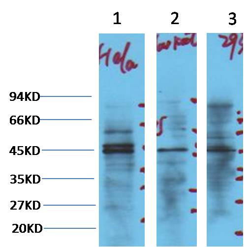 NSE Mouse mAb