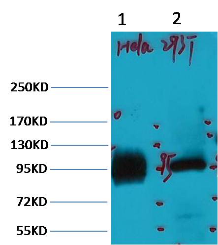 ABCB5  Mouse mAb