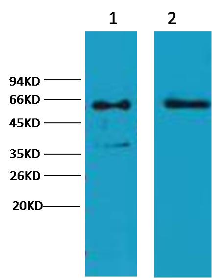Cytokeratin 6  Mouse mAb