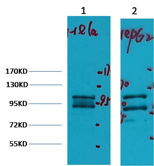 IDE/Insulin Degrading Enzyme Mouse mAb