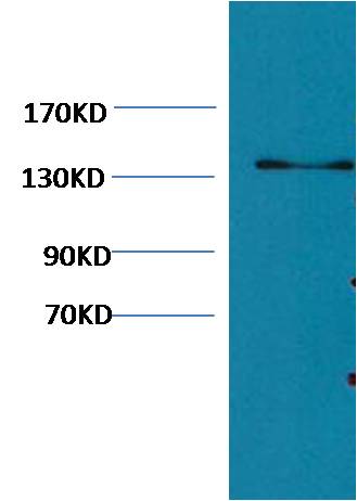 Collagen III Mouse mAb
