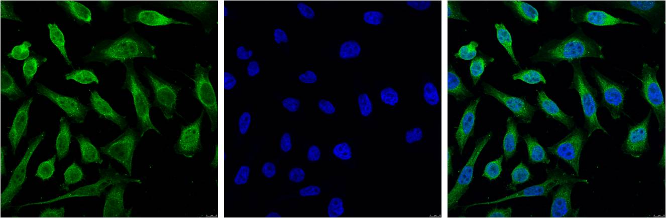 Progesterone Receptor Mouse mAb