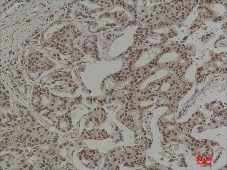 COX2/Cyclooxygenase 2 Mouse mAb