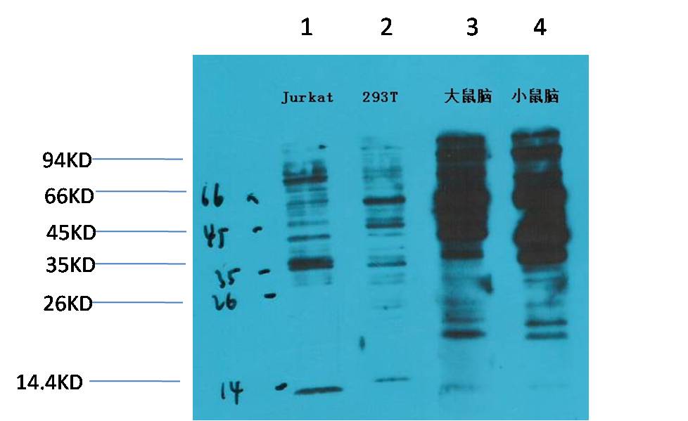 Phosphotyrosine Mouse mAb
