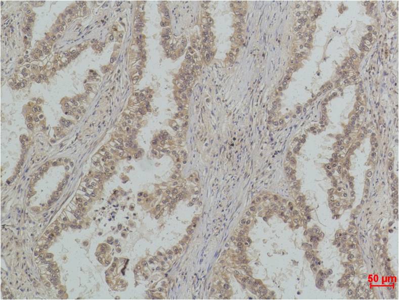 P53(Mono Methyl Lys370) Mouse mAb