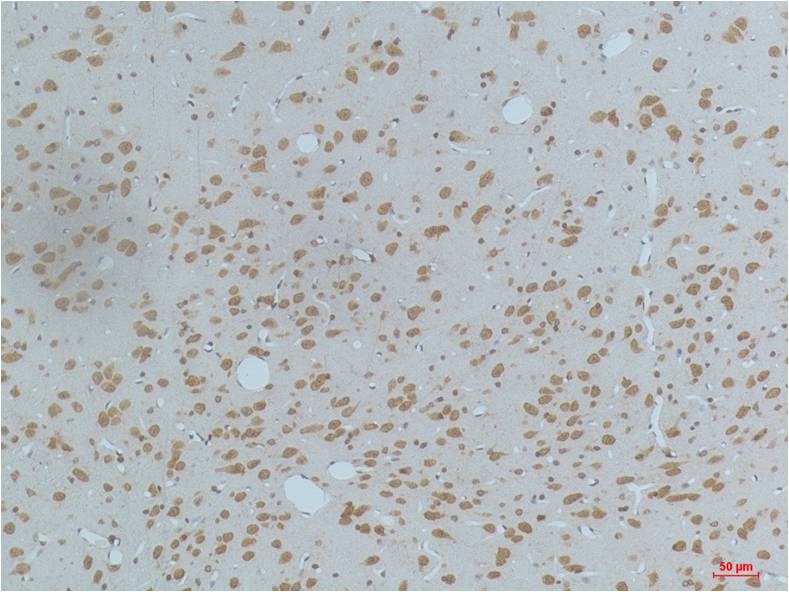 CaMKIIβ/γ/δ (Phospho Thr287) Mouse mAb