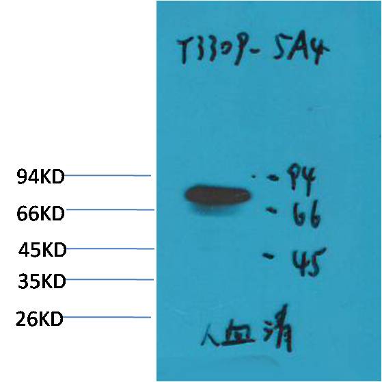 Transferrin Mouse mAb