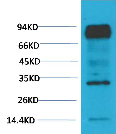 HIF-1 β/ARNT Mouse mAb