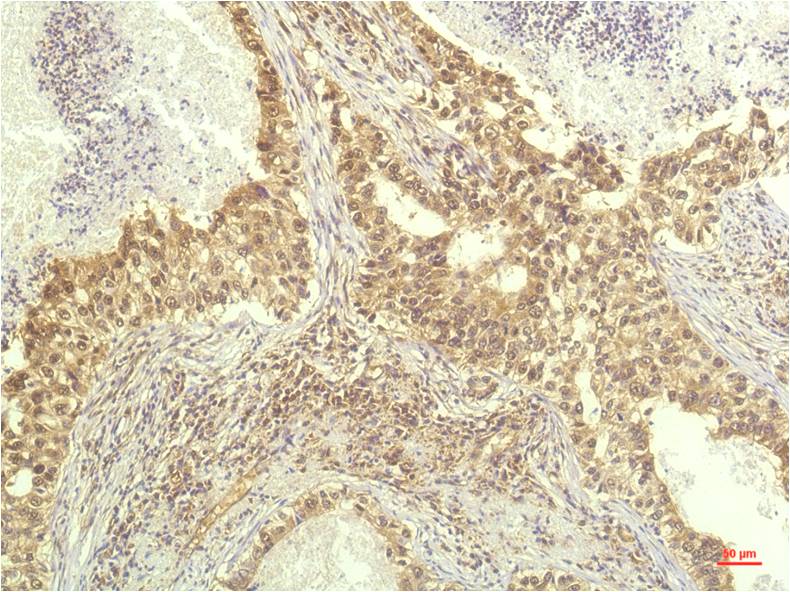 P70 S6 Kinase (1C7) Mouse mAb