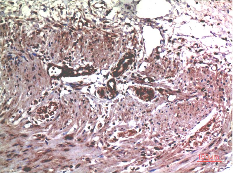 MMP2 (1H1) Mouse mAb