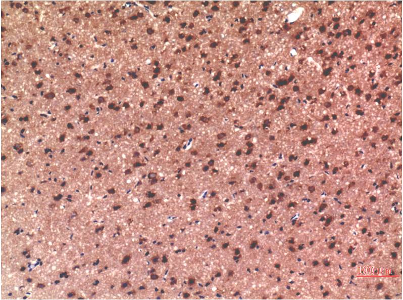 Tau (10E3) Mouse mAb
