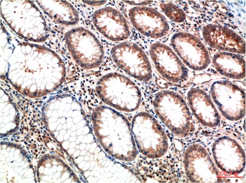 ATM (1D1) Mouse mAb