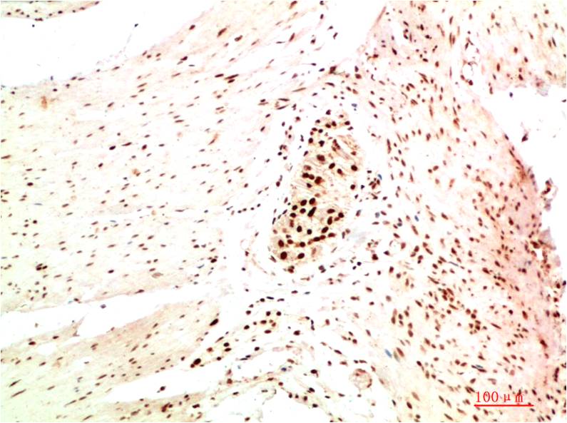 HP-1α (5E3) Mouse mAb