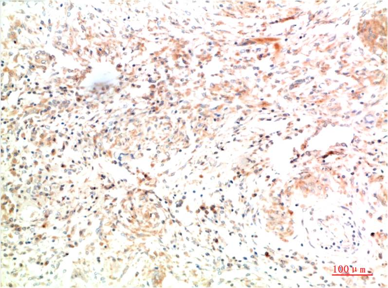 Collagen II (8F6) Mouse mAb