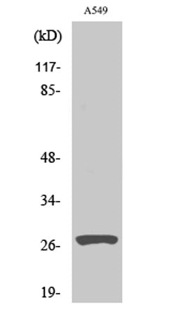 Cleaved-Cathepsin D HC (L169) rabbit pAb