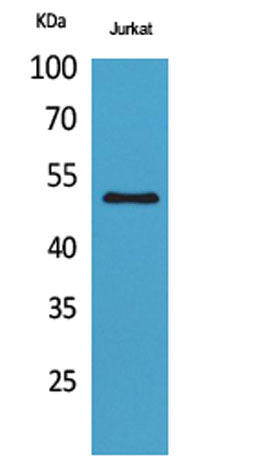 HNF-3α/β/γ (Acetyl Lys264/253/211) rabbit pAb