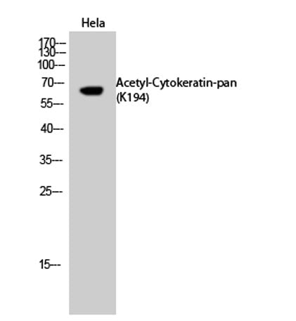 Cytokeratin-pan (Acetyl Lys194) rabbit pAb