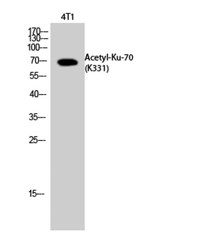 Ku-70 (Acetyl Lys331) rabbit pAb