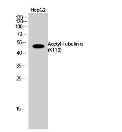 Tubulin α (Acetyl Lys112) rabbit pAb