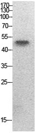 PTEN (Acetyl Lys402) rabbit pAb