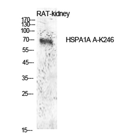 HSP70 (Acetyl Lys246) rabbit pAb