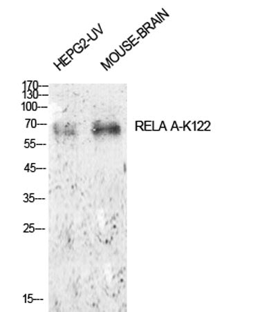 NFκB-p65 (Acetyl Lys122) rabbit pAb