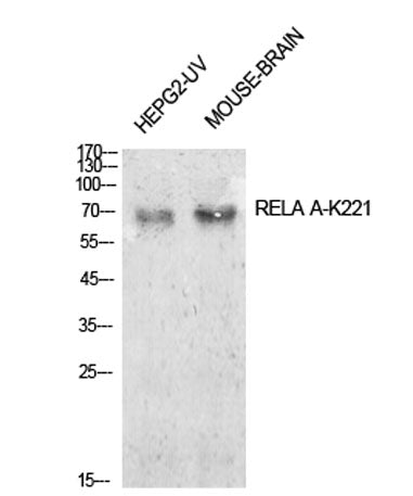 NFκB-p65 (Acetyl Lys221) rabbit pAb