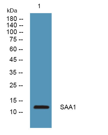 SAA1 rabbit pAb