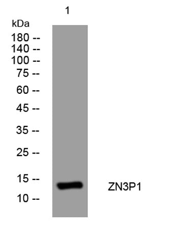 ZN3P1 rabbit pAb